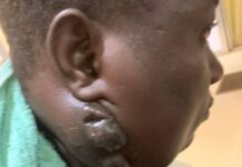 Conakry : malade, Mohamed Touré sollicite un appui financier