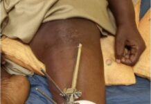 Attaque de la maison centrale : Mabinty Soumah atteinte d’une balle, prise en charge à Donka…